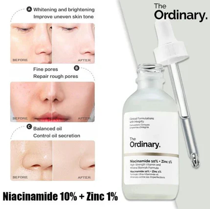 The Ordinary Niacinamide Serum 10% + Zinc 1% Supersize Serum 30ml | Best Quality Serum 30ml